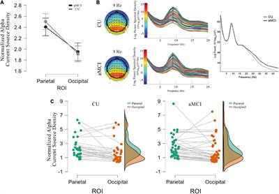 Resting state electroencephalographic rhythms are affected by immediately preceding memory demands in cognitively unimpaired elderly and patients with mild cognitive impairment